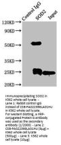 SOD2 Antibody