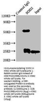 SOD2 Antibody