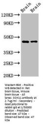 SOX11 Antibody