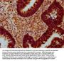 SOX30 Antibody