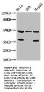SOX4 Antibody