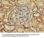 SP110 Antibody