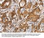 SLC5A11 Antibody