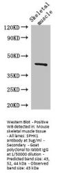 SPHK1 Antibody