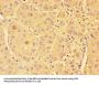 SPHK1 Antibody