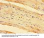 SPHK1 Antibody