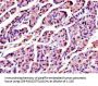 SPINK1 Antibody