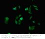 SPINK1 Antibody
