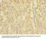 SPOP Antibody