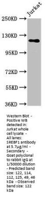 SREBF1 Antibody