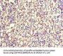 Rabbit anti-human Serglycin polyclonal Antibody(SRGN)
