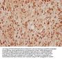 SRPK2 Antibody