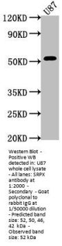SRPX Antibody
