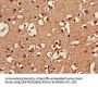 SRR Antibody