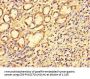 SS18L1 Antibody