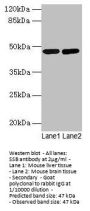 SSB Antibody