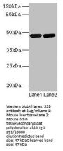 SSB Antibody