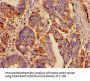 SST Antibody
