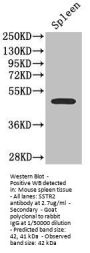 SSTR2 Antibody