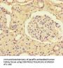 SSTR2 Antibody