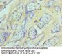 Rabbit anti-human Suppressor of tumorigenicity 14 protein polyclonal Antibody(ST14)