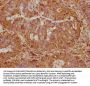 ST5 Antibody