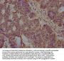 ST5 Antibody
