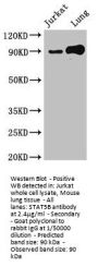 STAT5B Antibody