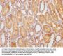 STATH Antibody