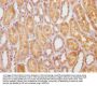 STATH Antibody