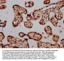 STH Antibody