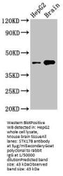STK17B Antibody