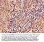 STK17B Antibody