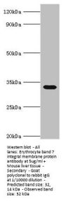 STOM Antibody