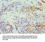 STOM Antibody