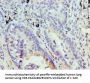 STOM Antibody