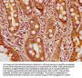 SULT1A2 Antibody