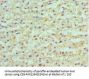 SULT2A1 Antibody