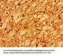 SV2A Antibody