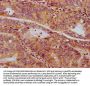 SV2C Antibody