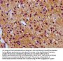 SV2C Antibody