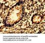 SYK Antibody