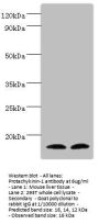Rabbit anti-human Protachykinin-1 polyclonal Antibody(TAC1)