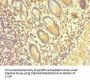 Rabbit anti-human Protachykinin-1 polyclonal Antibody(TAC1)