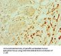 Rabbit anti-human Protachykinin-1 polyclonal Antibody(TAC1)