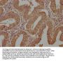 TAC1 Antibody