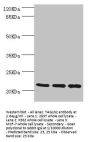 TAGLN2 Antibody