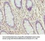 TAGLN2 Antibody