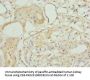 TAGLN2 Antibody