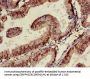 TARDBP Antibody